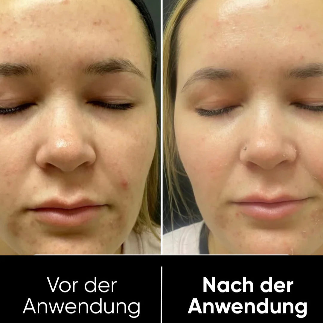 Peel Shot™ Exfoliant Rice Serum
