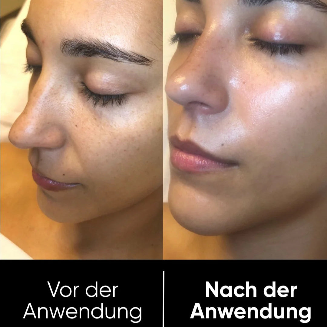 Peel Shot™ Exfoliant Rice Serum