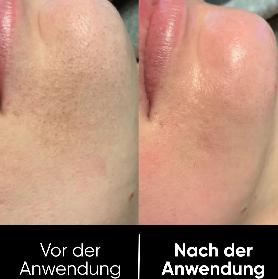 Peel Shot™ Exfoliant Rice Serum