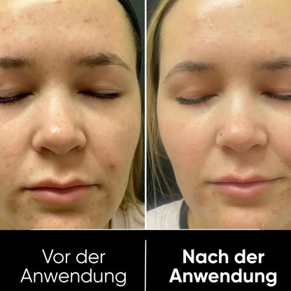 Peel Shot™ Exfoliant Rice Serum